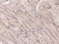 VDAC1 Recombinant Rabbit mAb, Mitochondrial Loading Control